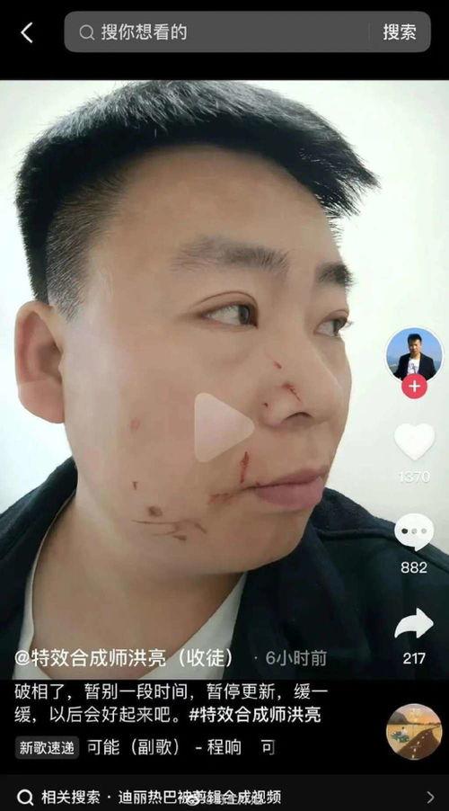 外国明星热吻视频大全,浪漫瞬间尽收眼底