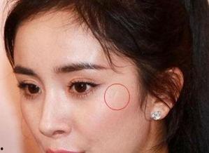 眉骨 疤痕 明星,眉骨疤痕下的明星蜕变之路